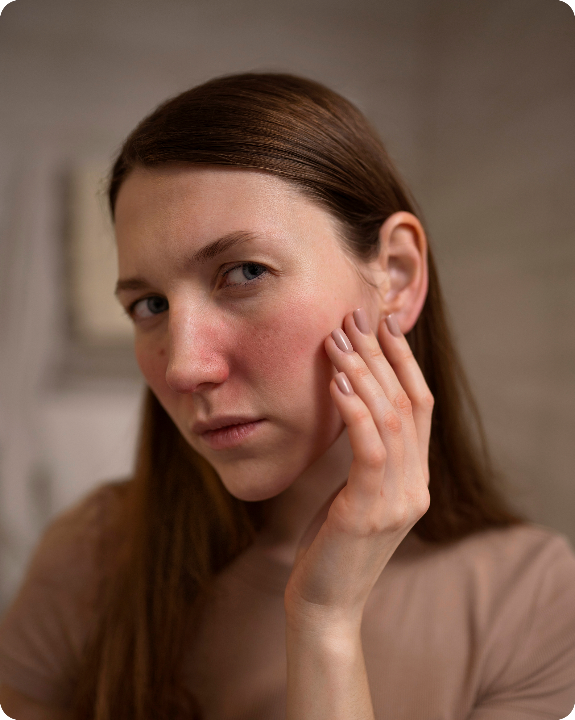 woman dealing with rosacea skin condition face 2